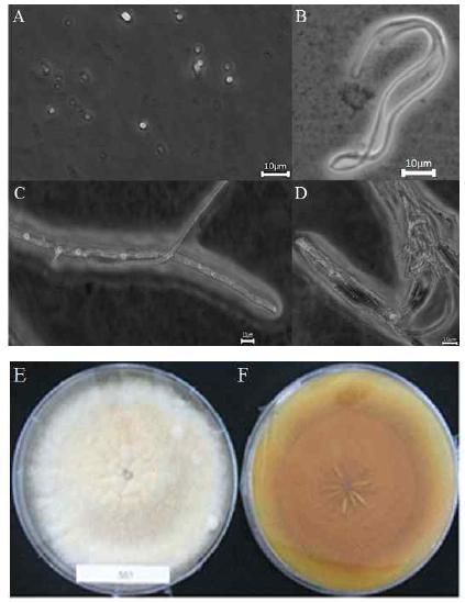 Morphology of the isolate KNU14-9 (Chaetomium madrasense) on potato dextrose agar (PDA).(A) Spore, (B-D) Mycelia, (E) Front view and (F) Back view.