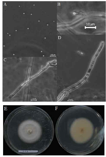 Morphology of the isolate KNU14-10 (Talaromyces purpurogenus) on potato dextrose agar (PDA).