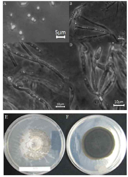 Morphology of the isolate KNU14-11 (Phialocephala lagerbergii) on potato dextrose agar (PDA). (A) Spore, (B, D) Hyphae, (C) Mycelia, (E) Front view and (F) Back view.