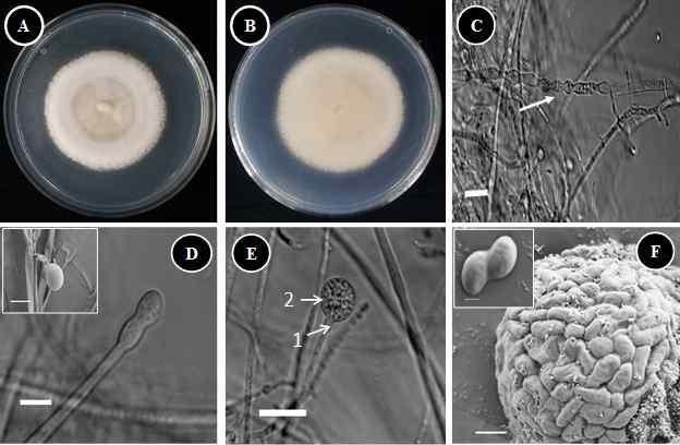 Morphology of Gongronella butleri KNU14-13-1 observed using a compound microscope and scanning electron microscope (SEM): A.