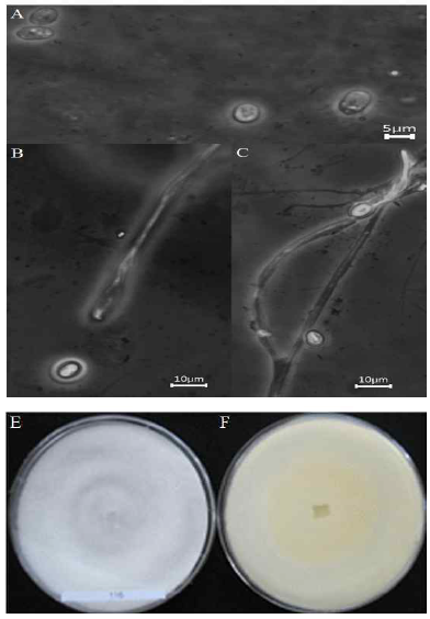 Morphology of the isolate KNU14-14 (Mortierella ambigua) on potato dextrose agar (PDA). (A) Spore, (B) Hyphae, (C) chlamydospore, (E) Front view and (F) Back view.