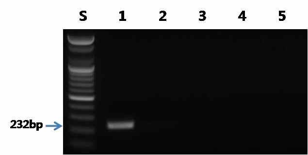 노루 프라이머를 이용한 PCR 결과.