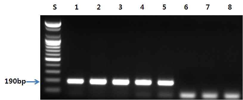 상어 프라이머를 이용한 PCR 결과.