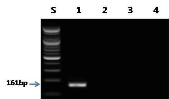 뱀장어 프라이머를 이용한 PCR 결과.