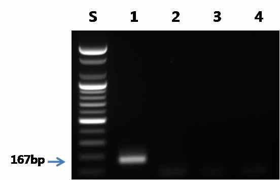 숭어 프라이머를 이용한 PCR 결과.