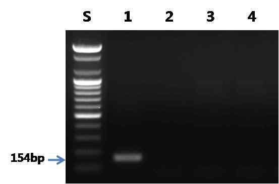 동자개 프라이머를 이용한 PCR 결과.