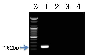 고려엉겅퀴(곤드레) 프라이머를 이용한 PCR 결과.