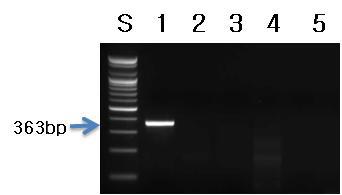 아파니조메논 플로스아쿠아(Aphanizomenon flos-aquae, AFA) 프라이머를 이용한 PCR 결과