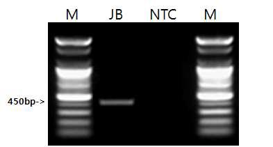 기생충 특이 프라이머를 이용한 시료의 PCR 결과.