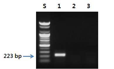 개선된 대구 특이 프라이머를 이용한 PCR 결과.