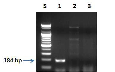 개선된 청대구 특이 프라이머를 이용한 PCR 결과.