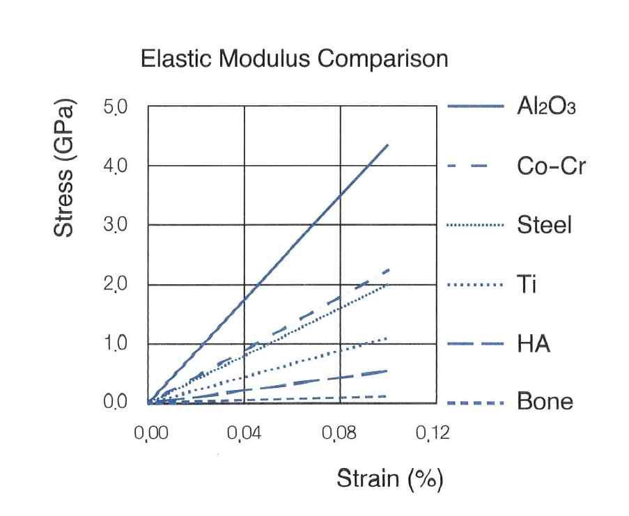 치과용 임플란트재와 골의 탄성계수를 비교한 응력-왜력곡선