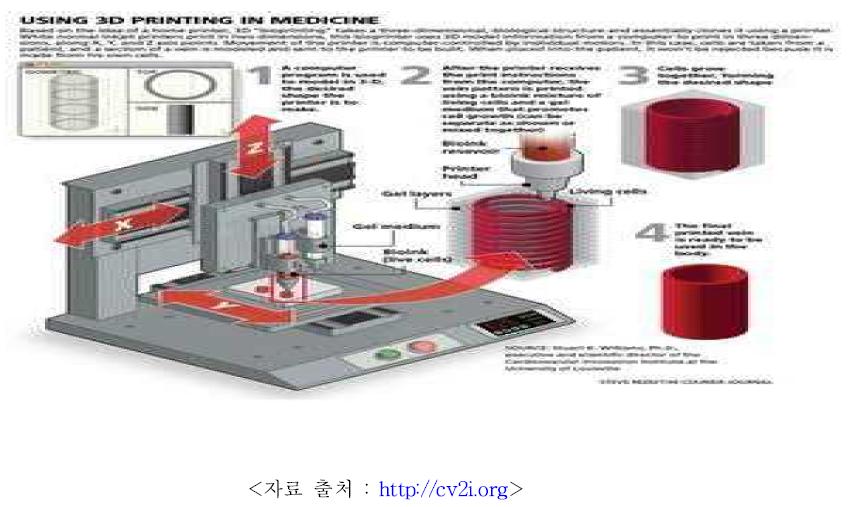 인공심장을 만드는 3D 프린팅 원리