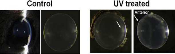 1개월된 실험용 쥐를 대상으로 한 자외선 노출과 수정체의 변화 모습