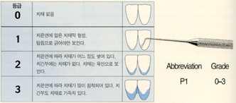 PI 등급 기준