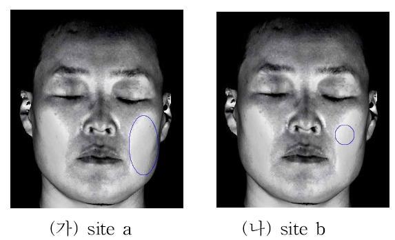 안면 분석 영역 (가) site a (팔자 주름을 제외한 볼 부위) (나) site b (pupil과 alar-facial groove의 수직 교차점)
