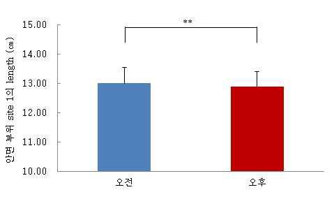 안면 부위 site 1 신체계측 결과 (㎝)