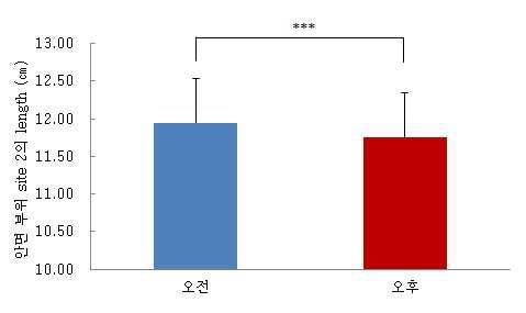 안면 부위 site 2 신체계측 결과 (㎝)