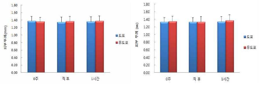 엘리드(좌)와 인하대(우)의 종아리 부위 피부 두께 즉시 시험 결과