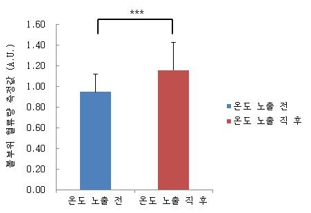 온도 노출 전, 후의 볼 부위 피부 혈류량 측정결과