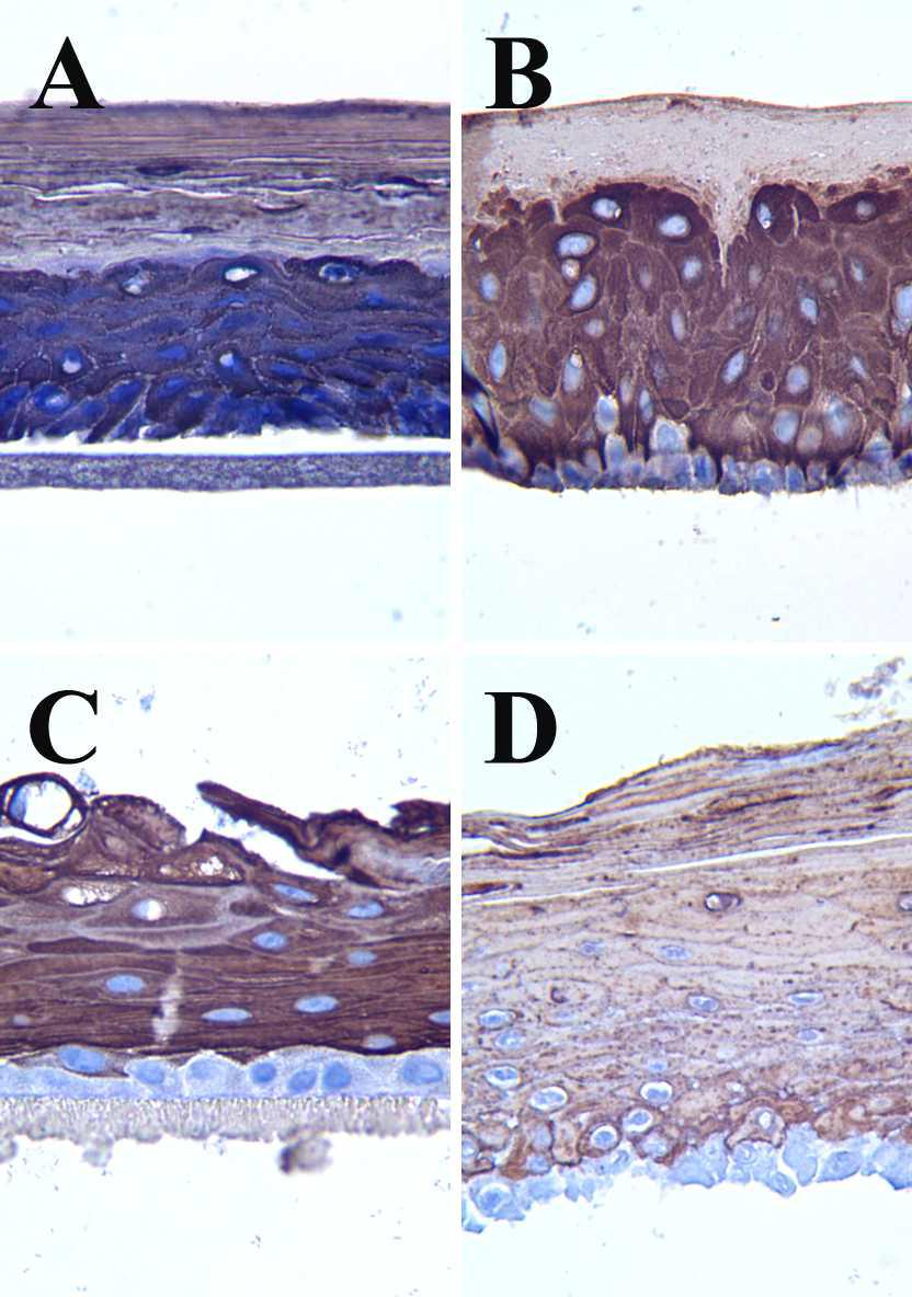 The representative images of the negative control group of the immunostain for cytokeratin 10 in each skin model