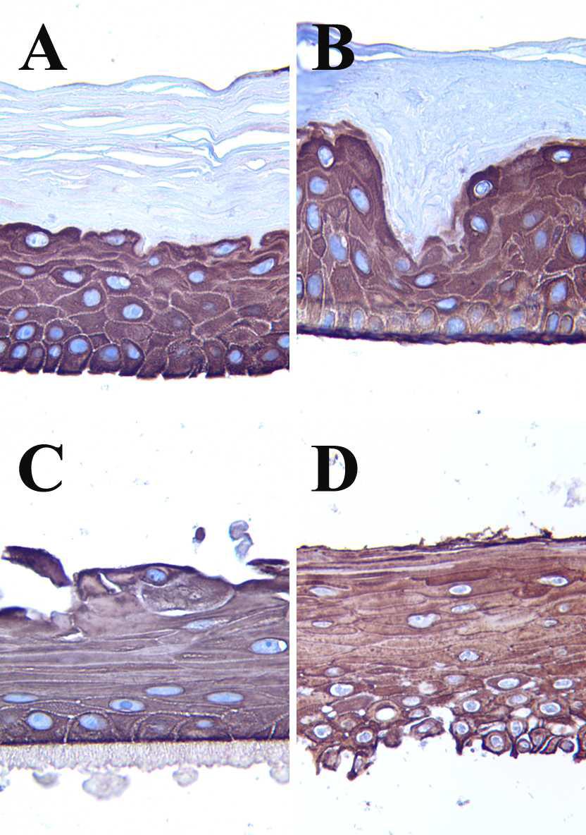 The representative images of the negative control group of the immunostain for cytokeratin 14 in each skin model