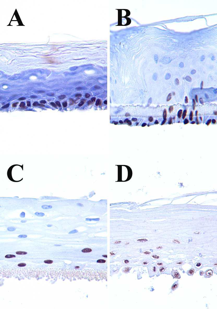 The representative images of the negative control group of the immunostain for p63 in each skin model