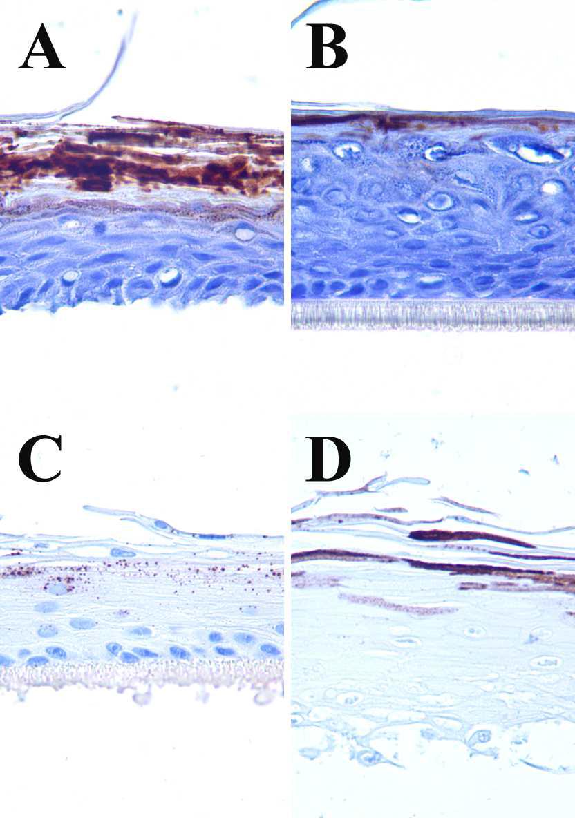 The representative images of the negative control group of the immunostain for filaggrin in each skin model