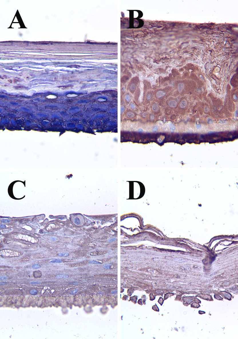 The representative images of the negative control group of the immunostain for ceramide in each skin model