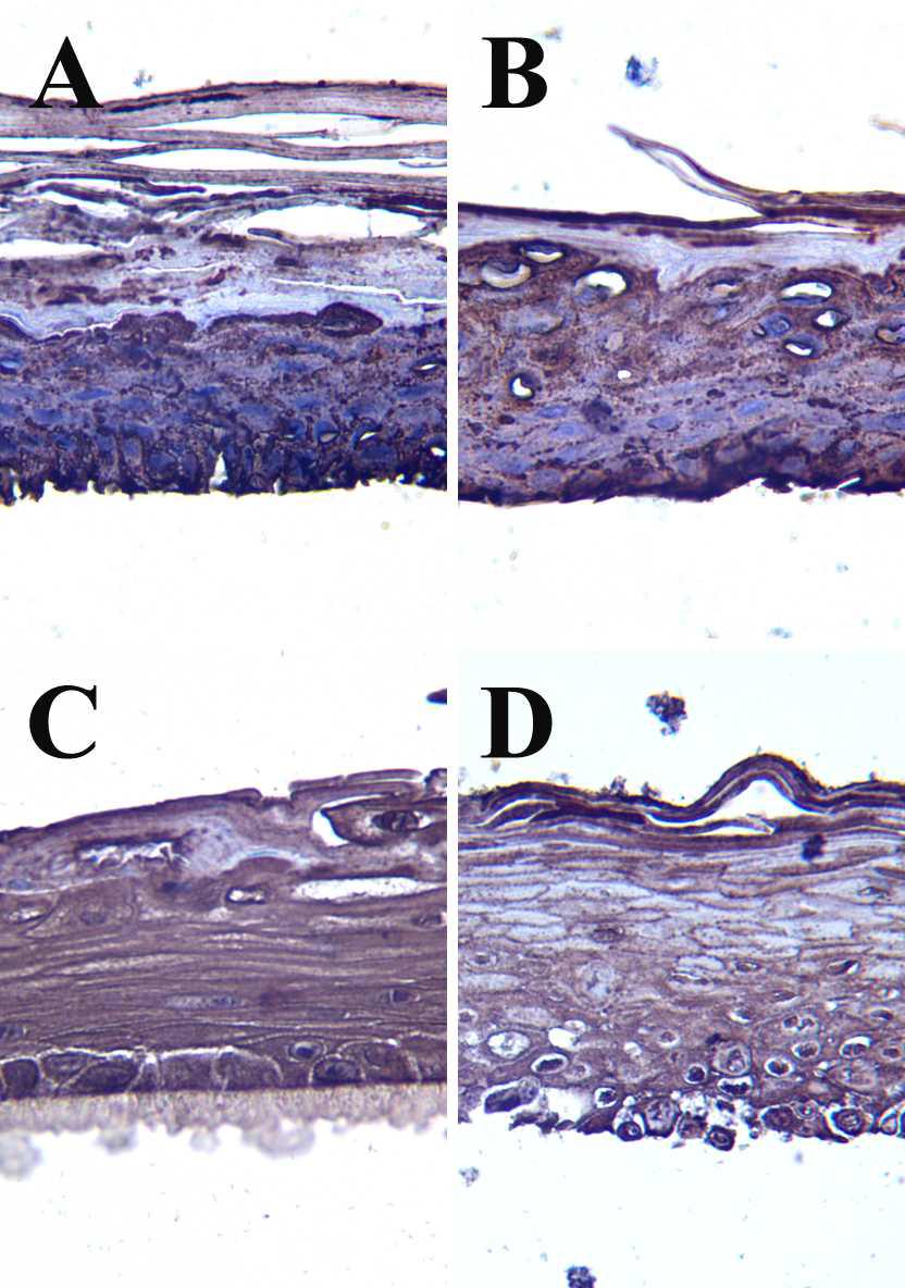 The representative images of the negative control group of the immunostain for fatty acid synthase in each skin model.