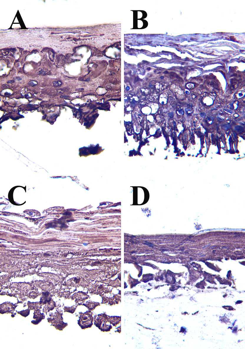 The representative images of the stimulant control group of the immunostain for fatty acid synthase in each skin model
