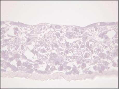 Histopathological features of mucous membrane of oral cavity.