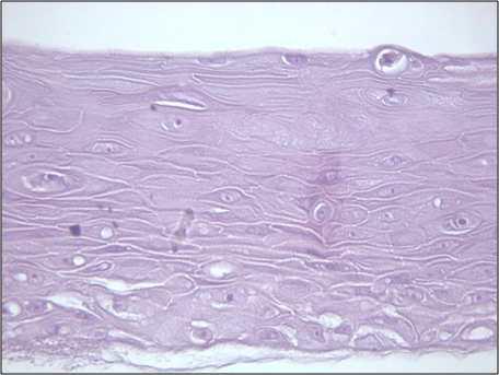 Histopathological features of mucous membrane of oral cavity.