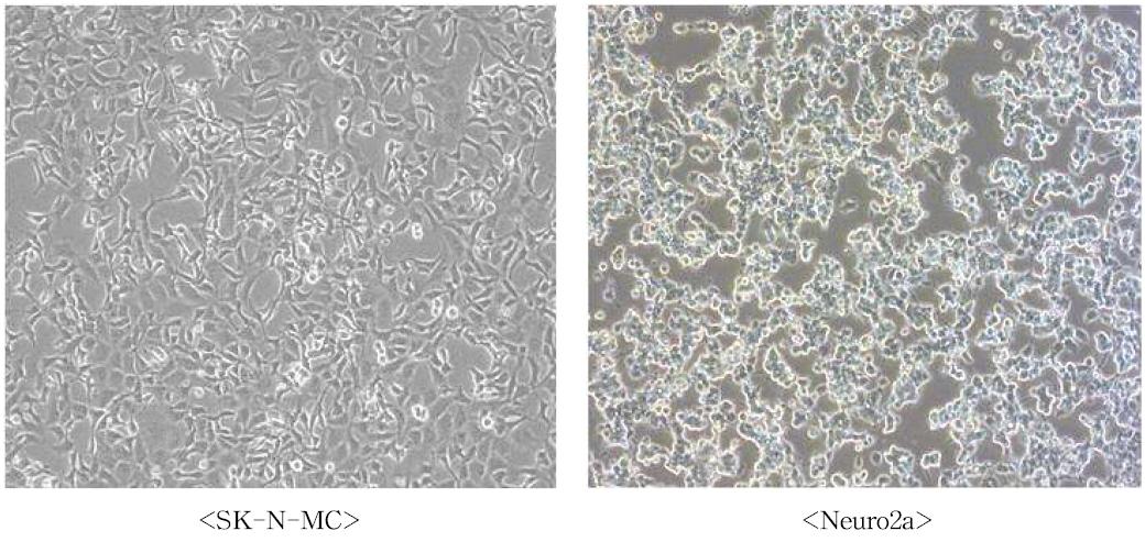 Neuronal cell culture (x100)