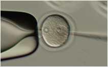 Linearized NSE-APH1a DNA fragment was microinjected into the male pronucleus of fertilized mice eggs.