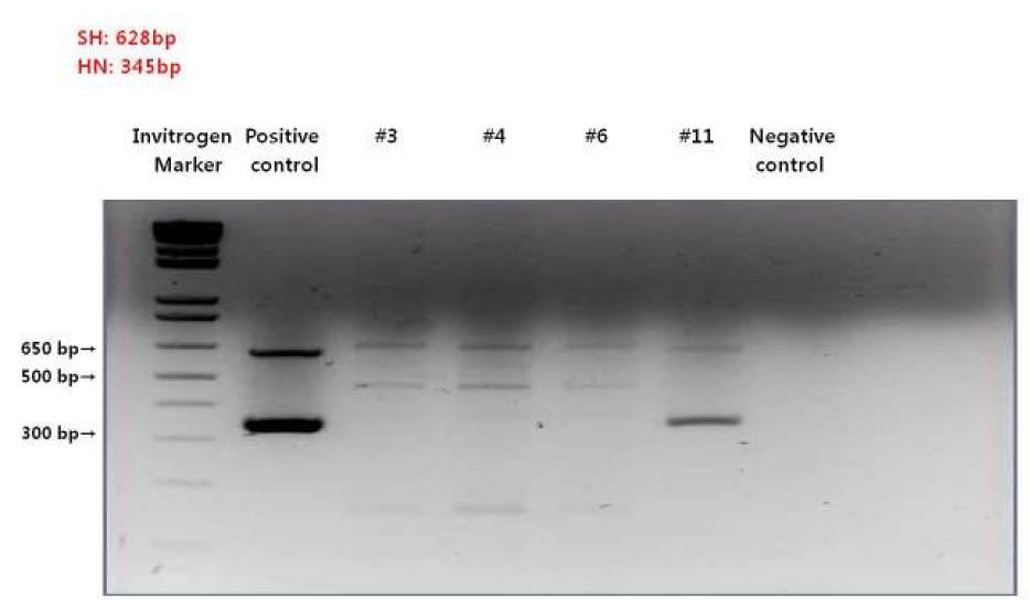 RT-PCR results in the patients