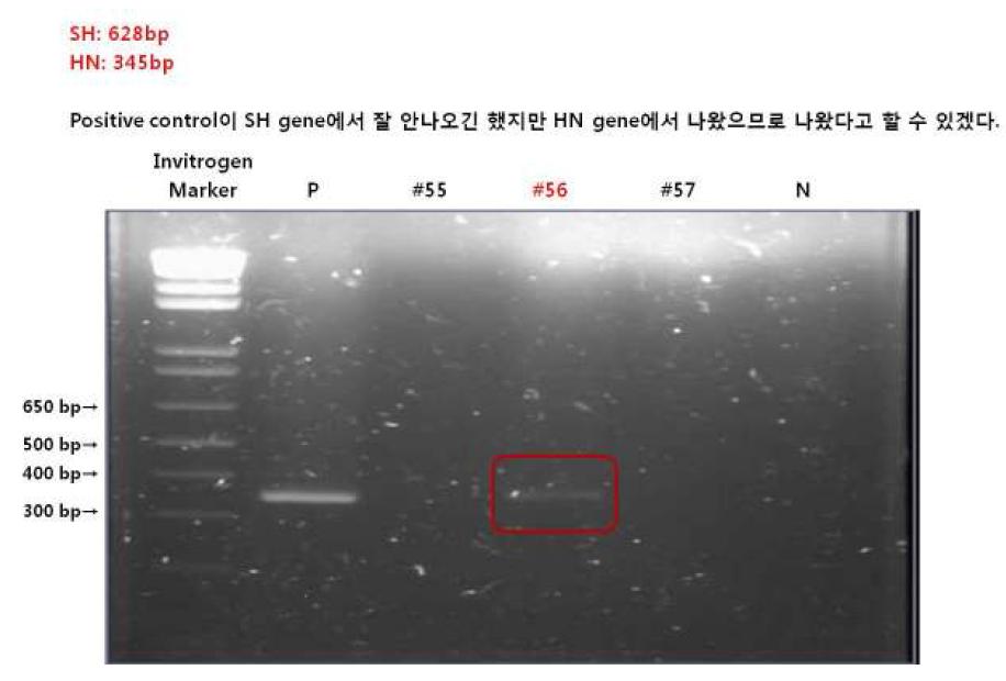 RT-PCR results in the patients