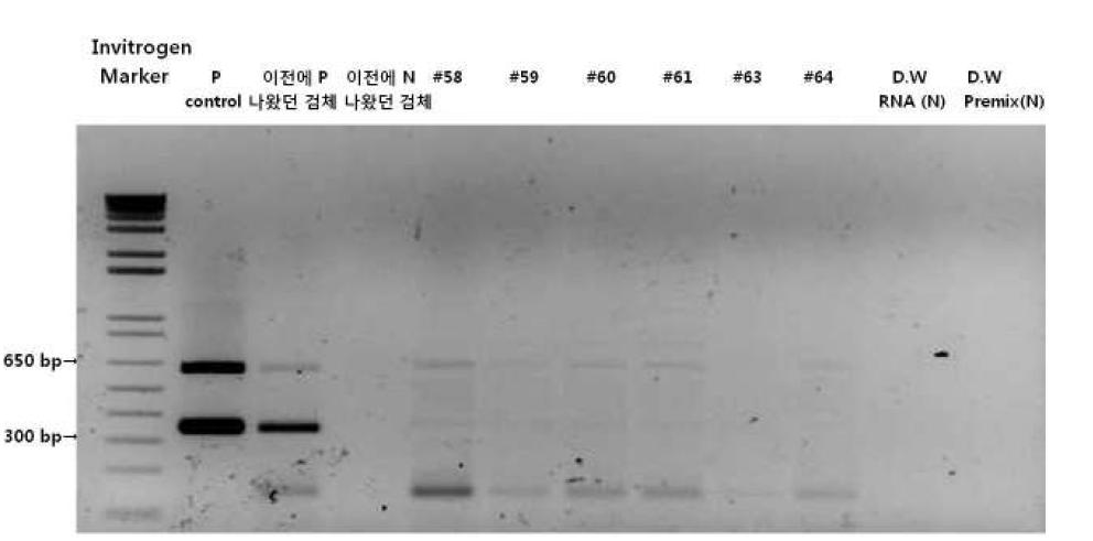 RT-PCR results in the patients