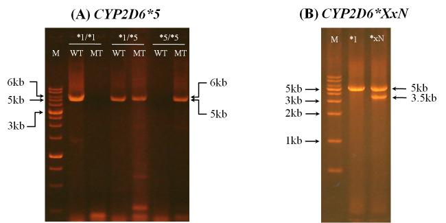 (A) CYP2D6*5와 (B) CYP2D6*XN 유전형 분석 결과