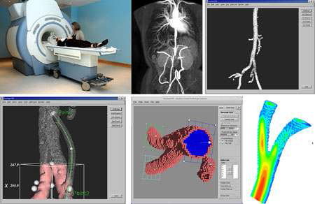 CrossGrid Medical Simulation