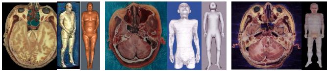 Visible Human (왼쪽), Chinese Visible Human (가운데), Visible Korean Human (오른쪽).