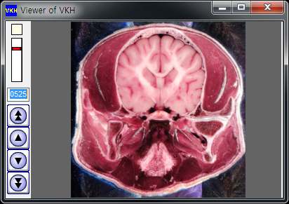 개 온몸의 절단면영상을 마음대로 골라볼 수 있는 둘러보기 소프트웨어