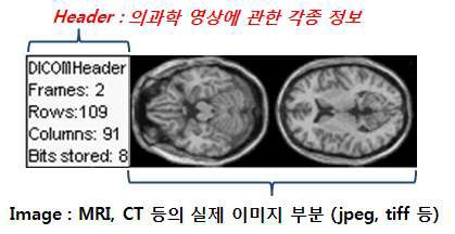 DICOM 파일 포맷