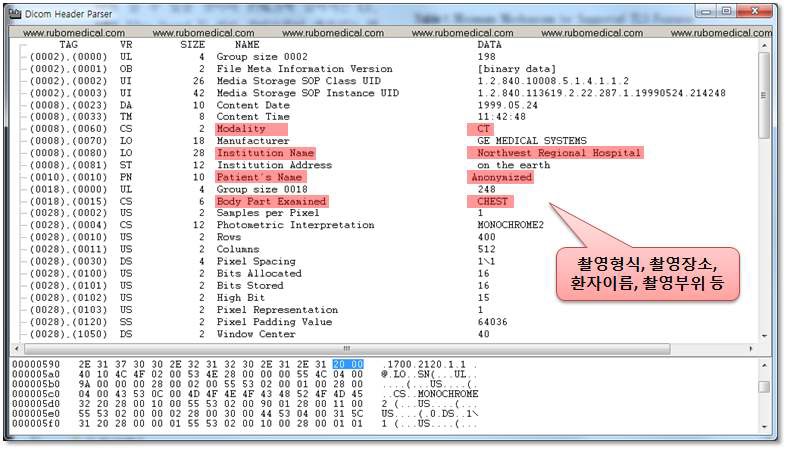 DICOM Header 예시