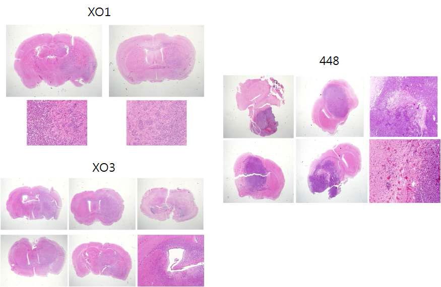 뇌종양 줄기세포주들의 orthortopic 종양 형성 H&E staining