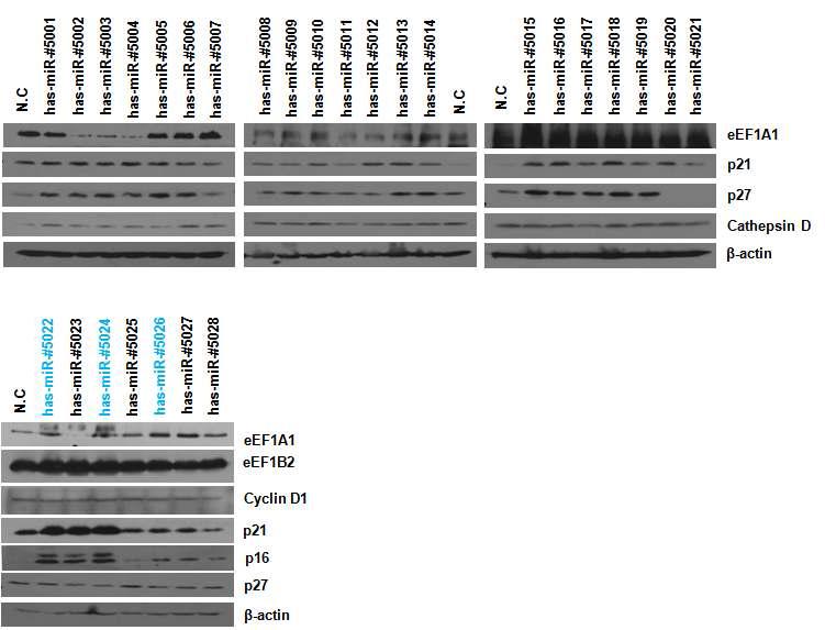 miRNA에 의한 유방암세포의 노화 유도.