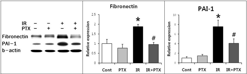 방사선 폐섬유화 모델에서 펜톡시필린의 투여에 의한 Fibronectin 과 plasminogen activator inhibitor -1변화