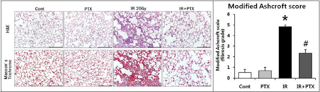 방사선 폐섬유화 모델에서 펜톡시필린의 치료효과의 조직학적 분석 방사선 피폭 16주차 우측 폐의 대표적 H&E, Masson
