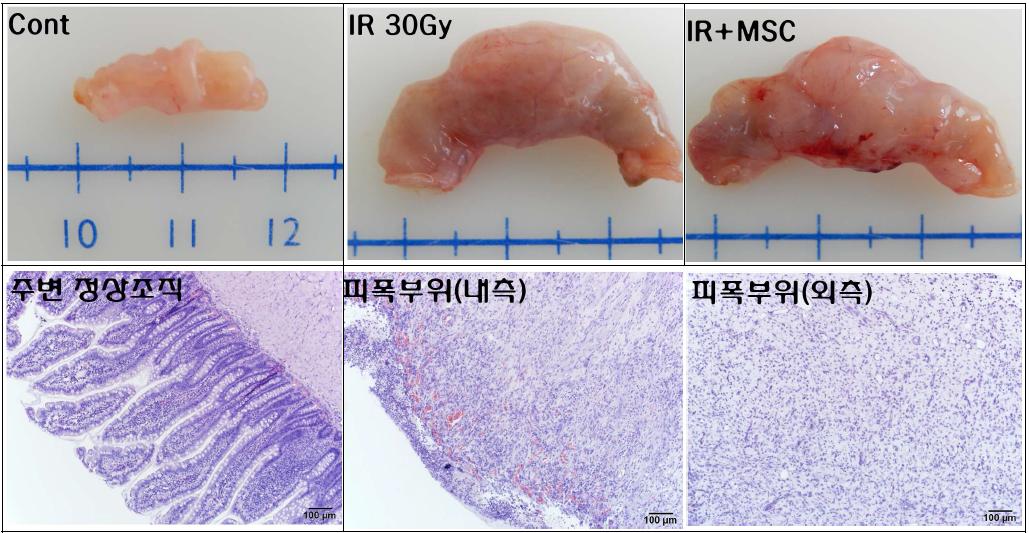피폭 4주 후 말단회장의 육안적 및 조직학적 변화
