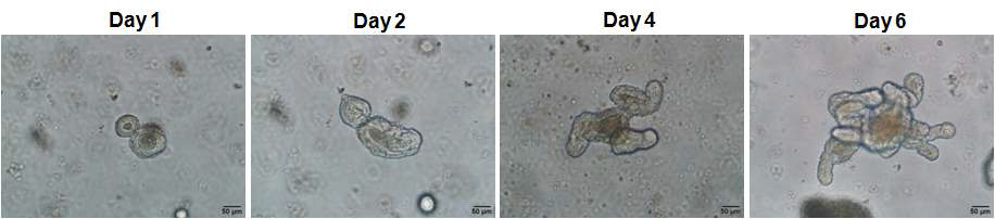 Organoid formation in 3D culture system. Bright-field images of small-intestinal crypts in ENR-CV culture system : EGF, Noggin and R-spondin 1 (ENR) media containing 3uM CHIR99021, 1mM valproic acid.